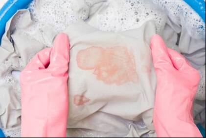 Las manchas amarillas aparecen en la ropa, sobre todo en la blanca o de colores muy claros (Foto: iStock)