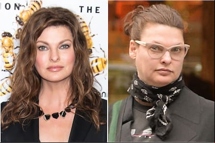 Linda Evangelista antes y después del tratamiento estético que la arruinó para siempre