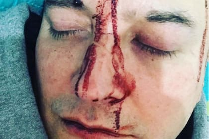 Según los videos que el cantante de pop publicó en su cuenta de Instagram, el confuso episodio ocurrió en un bar cercano a su domicilio en el partido bonaerense de General Rodirguez
